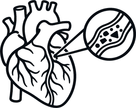 A heart with an artery cross-section magnified.